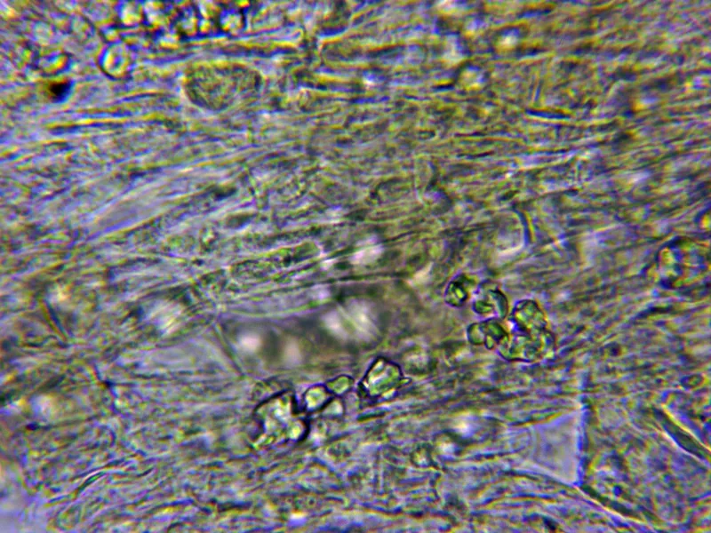 Ciboria amentacea 10 - Excípulo Melzer 3